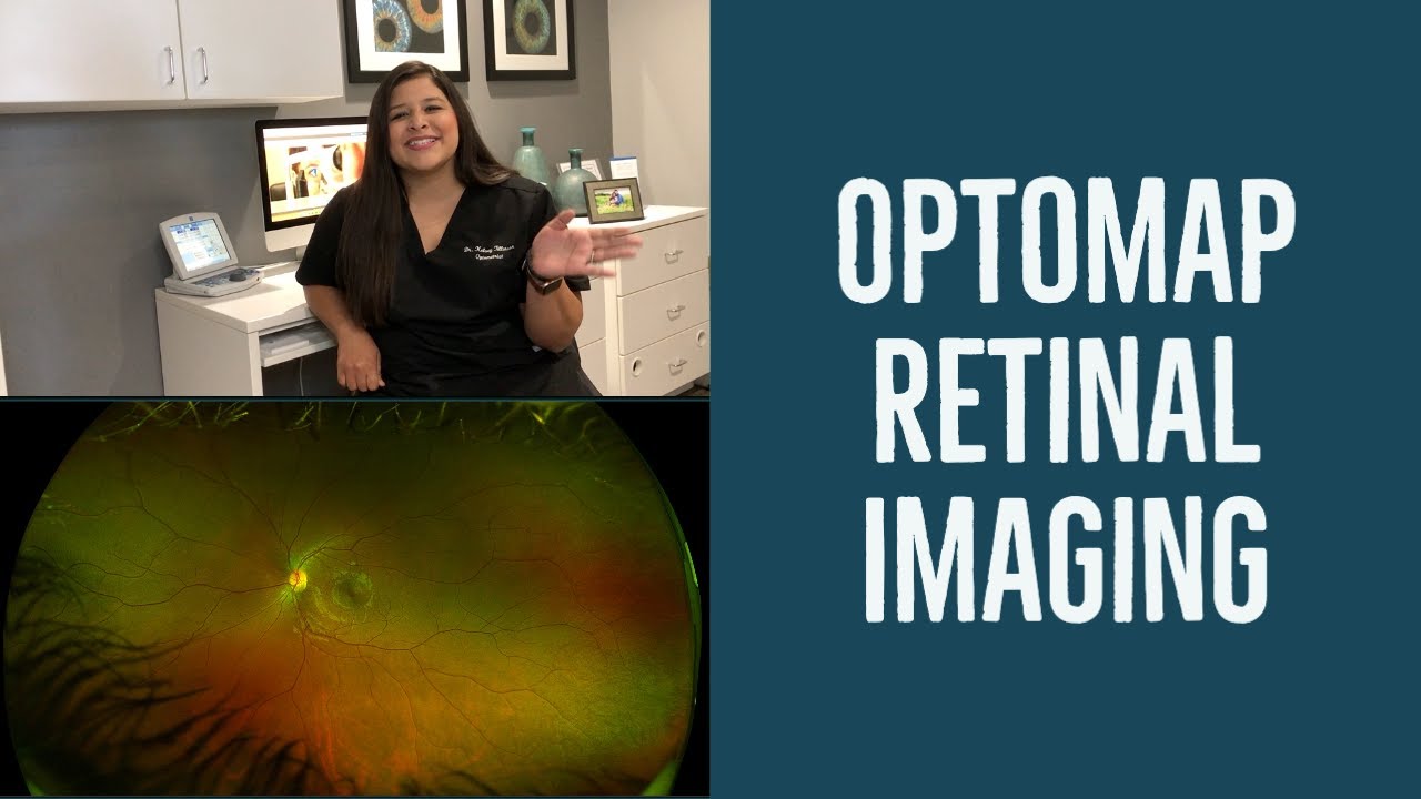 Retinal Optomap Imaging