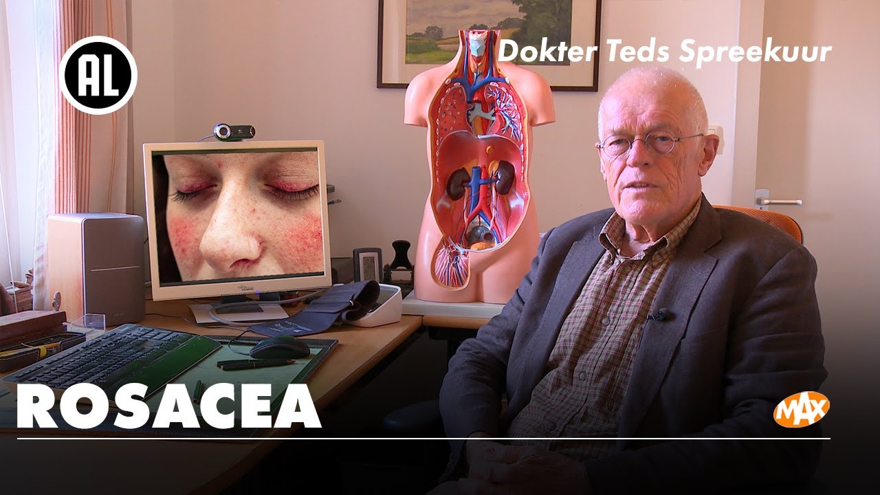 Rosacea - Wat is het en is er iets aan te doen? | DOKTER TEDS SPREEKUUR
