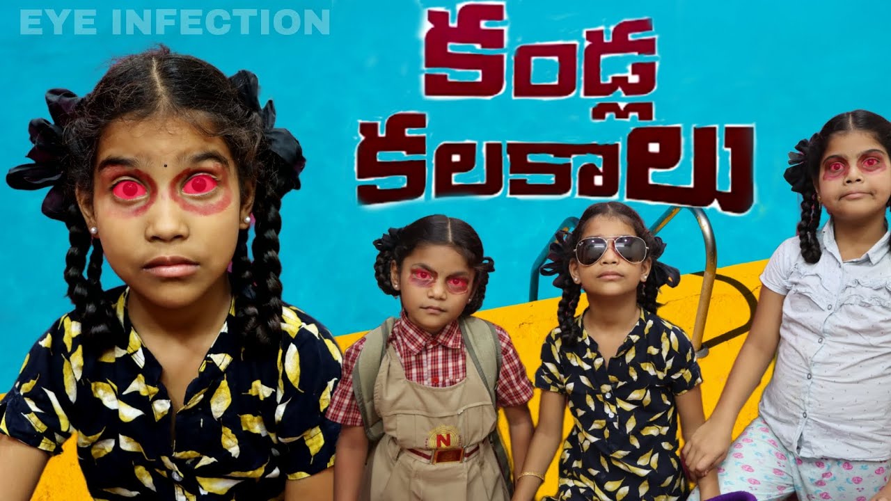 కండ్ల కలకాలు || కండ్లు వచ్చినాయి || eye infection|| rider mallesh new video || janavi eye infection