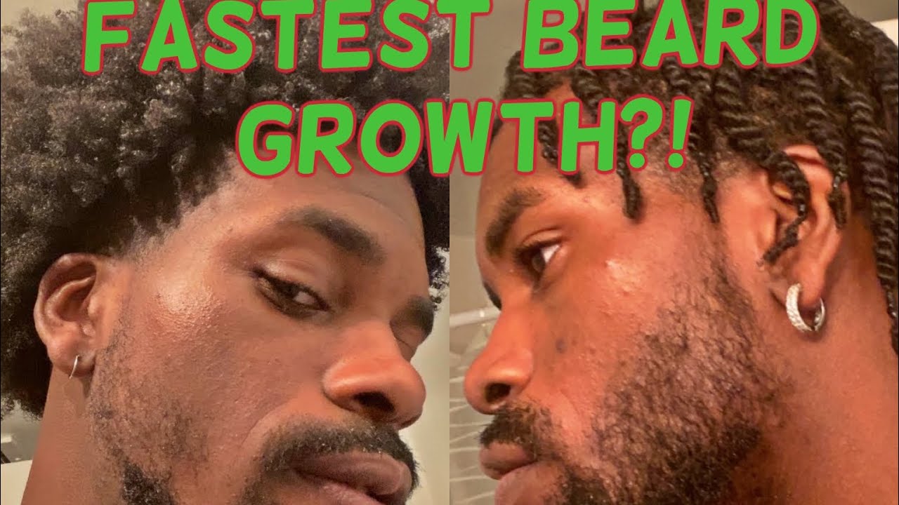 HOW TO GROW A BEARD EXTREMELY FAST In 4 weeks (Minoxidil)