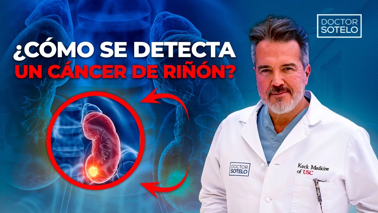 ¿Tengo que perder todo el riñón si tengo cáncer? 🚑 Dr. René Sotelo 🩺 Cáncer de riñón