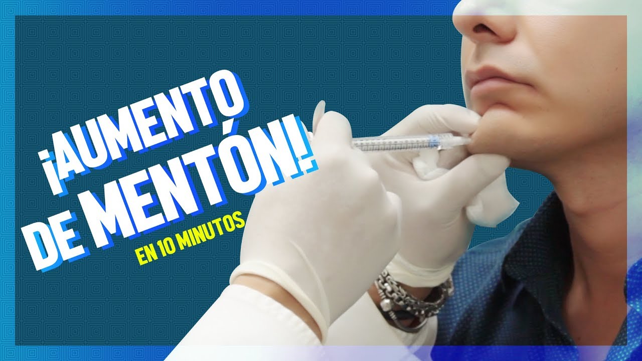 SIN CIRUGÍA (Aumento de Mentón) | Javierderma