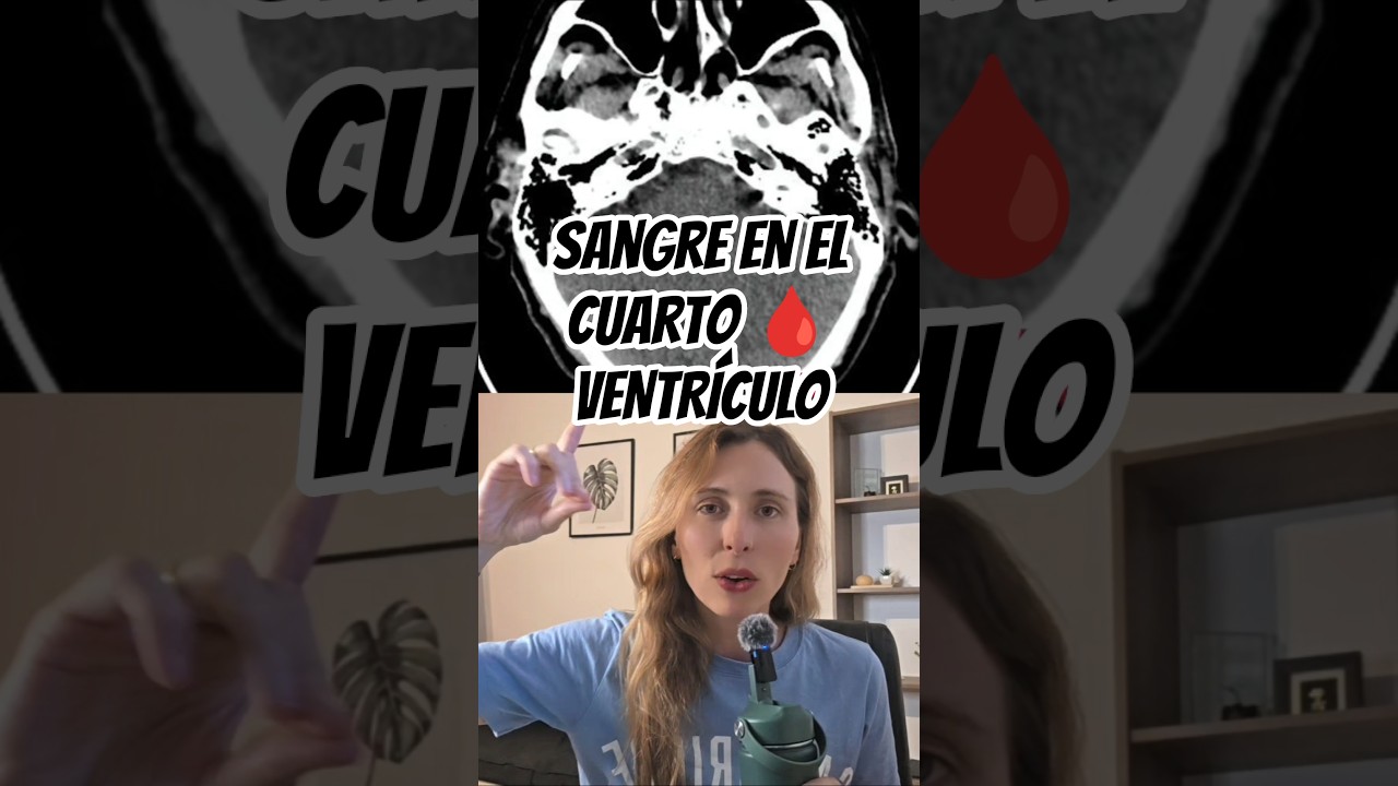 parte 1/5 fosa posterior 🧠 en 