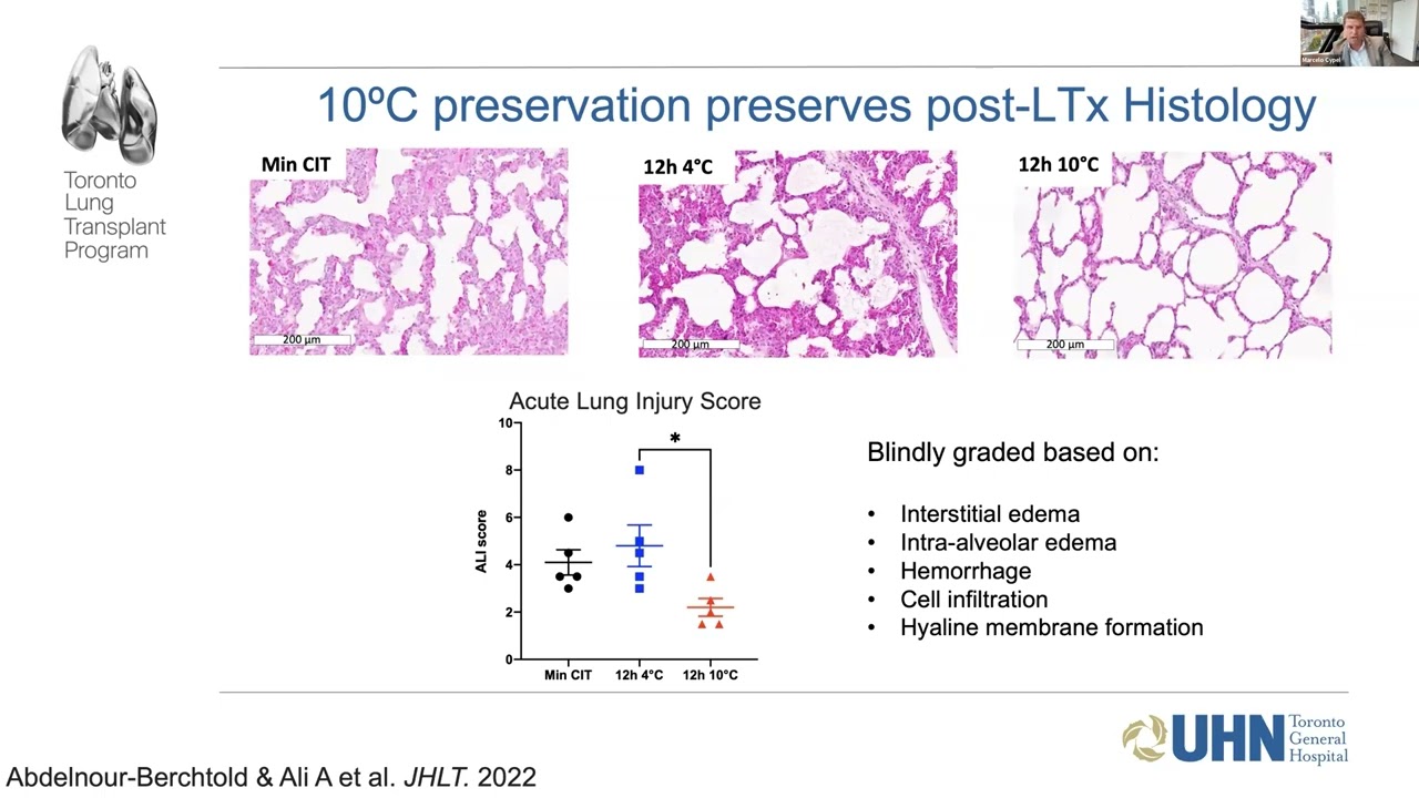 Prolonged Static Lung Storage: Refrigerated or on Ice?, October 18, 2022