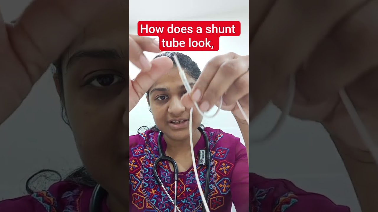 shunt dikhta kaisa hai!how does a shunt actually look,
