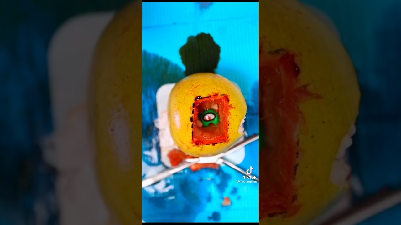 Discount Dentist 🦷| Tiktok Compilation