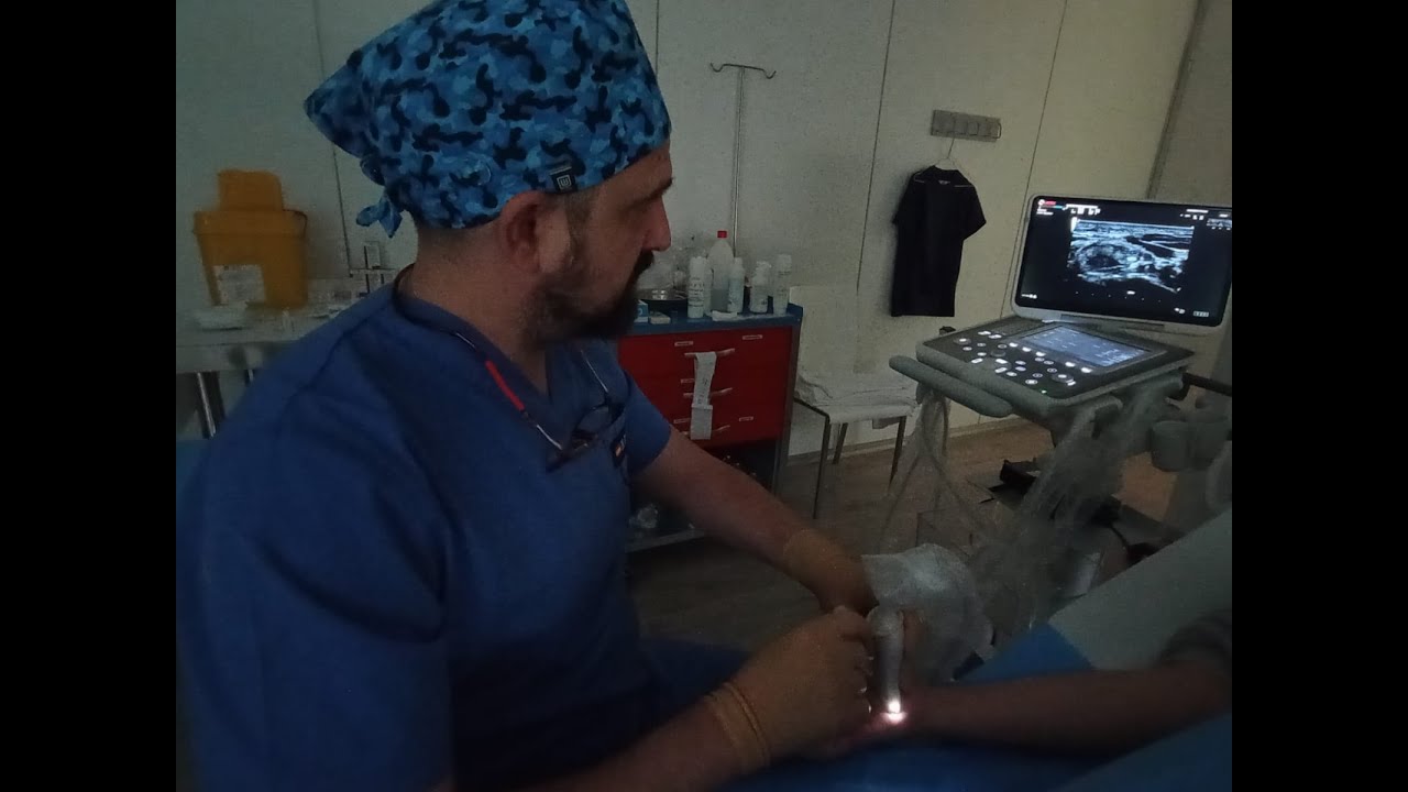 Bloqueo ecoguiado del nervio dorsal cutáneo | Madrid – Dr. Bellón