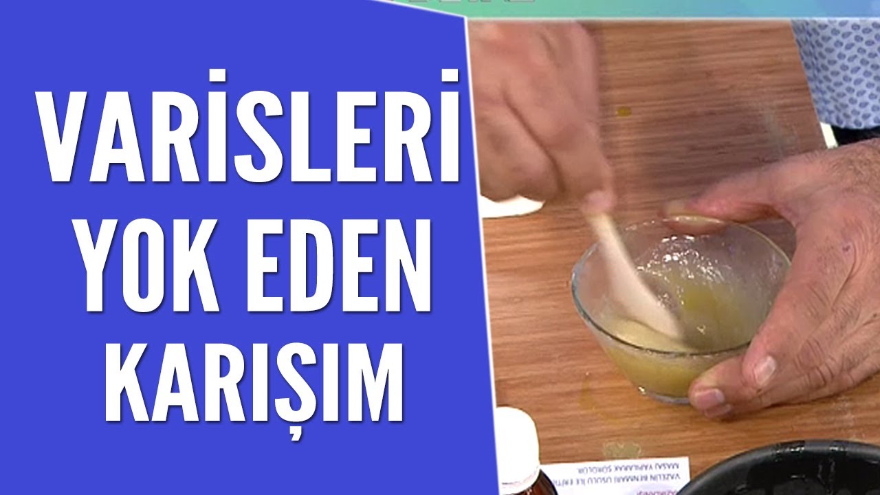 Varisleri yok eden karışımın tarifi ve yapılışı...