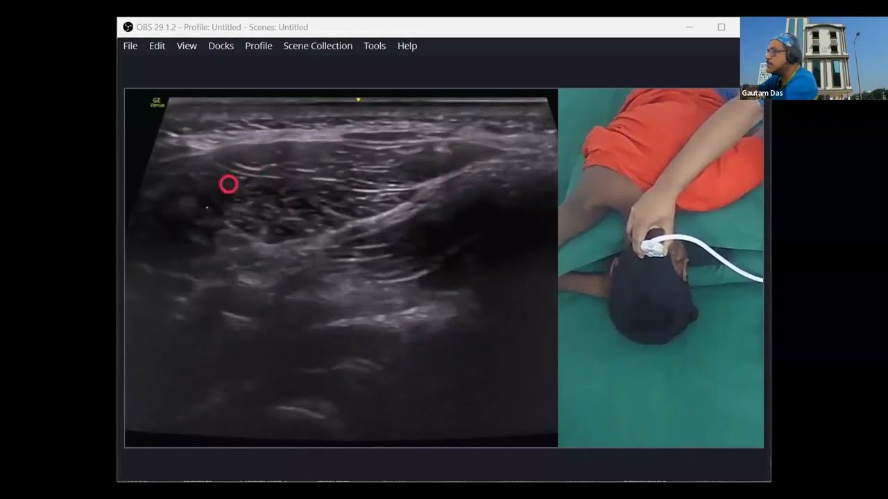 Posterior neck SonoAnatomy | Greater Occipital Nerve | Lesser Occipital Nerve | 3rd Occipital Nerve