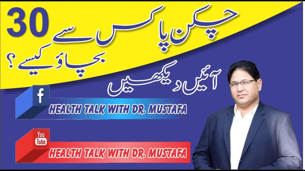 30  Chicken Pox   چکن پاکس سے بجاؤ