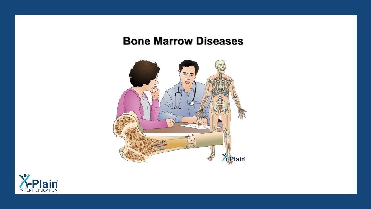 Bone Marrow Diseases