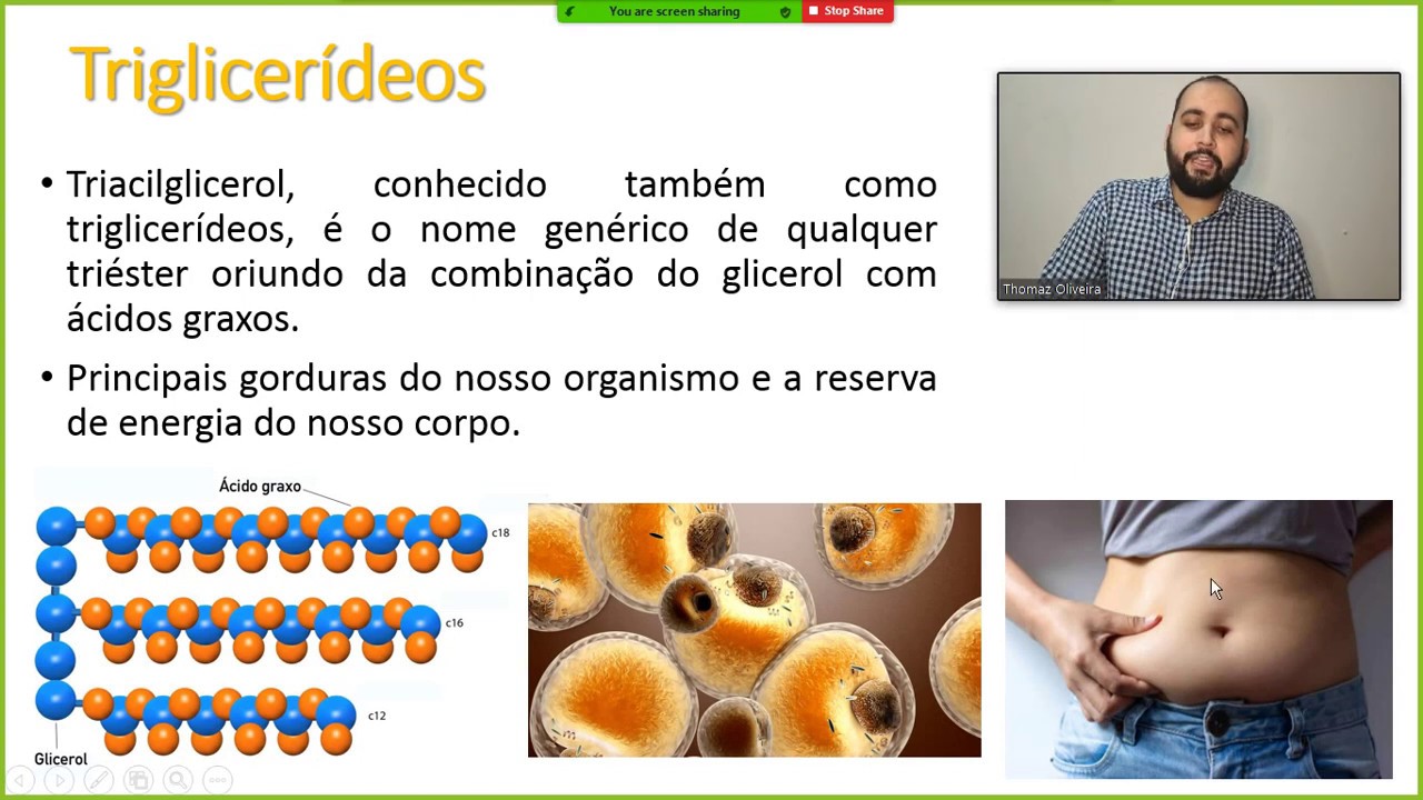 Bioquímica II - Dislipidemias - lipidograma - colesterol, HDL, LDL e triglicerídeos