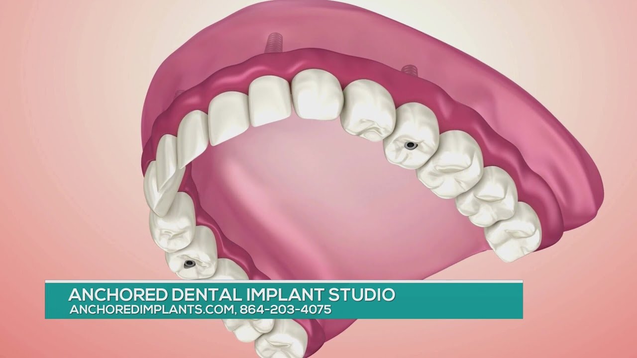 ANCHORED DENTAL FEB 26