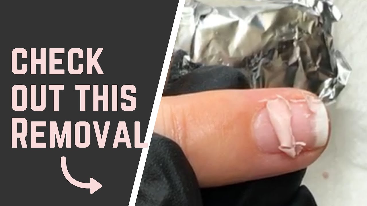 Bio Sculpture Evo2 soak off removal. [SHOCKING RESULTS!]