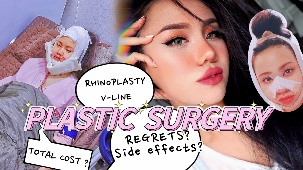 MY PLASTIC SURGERY EXPERIENCE | before & after, cost and regrets with facial contour + rhinoplasty
