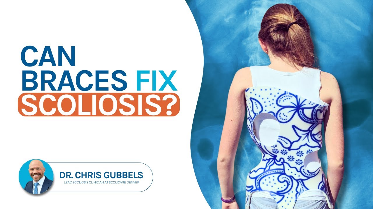 Scoliosis Braces for Kids: What Every Parent Must Know