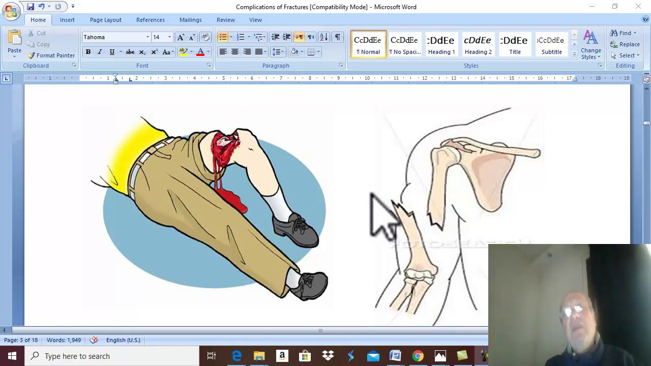 Orthopedic in Arabic 6 (  Complications of fractures , part 1 ) , by Dr. Wahdan .