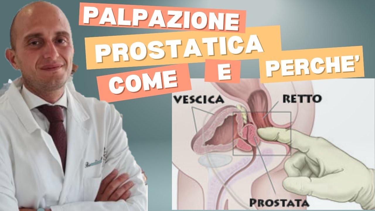PALPAZIONE PROSTATICA. E' ANCORA UTILE NEL 2025?
