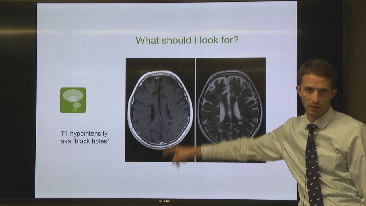 OhioHealth Multiple Sclerosis Lecture-Understanding Your MRI