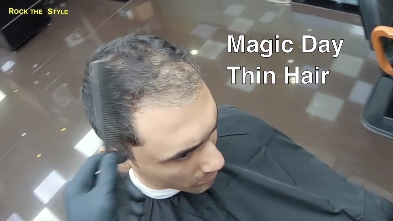 Hair Makeover | How To Change Men's Hairstyle | Hair Loss  Treatment
