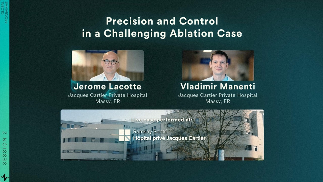 Live Case & Discussion: Precision and Control in a Challenging Ablation Case | RIO 2025