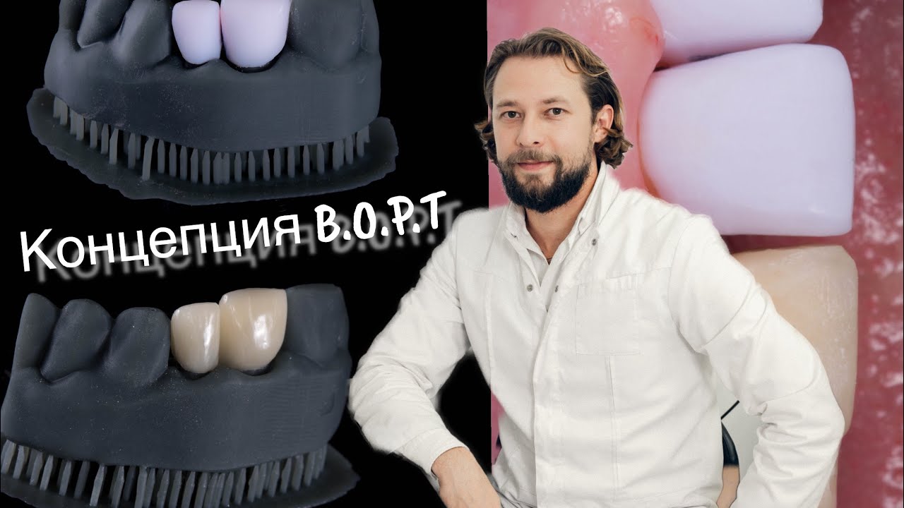 Клинический случай концепция вертипреп , B.O.P.T #стоматология #кариес #пломба #стоматолог #имплант