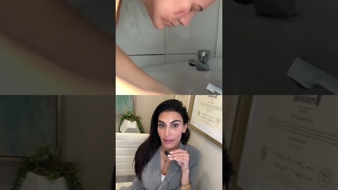 Узелково-кистозное акне #шорты