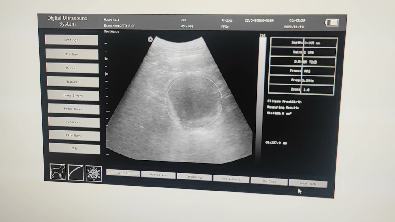 ULTRASONOGRAFO CONTEC CMS600P2 PARTE 4