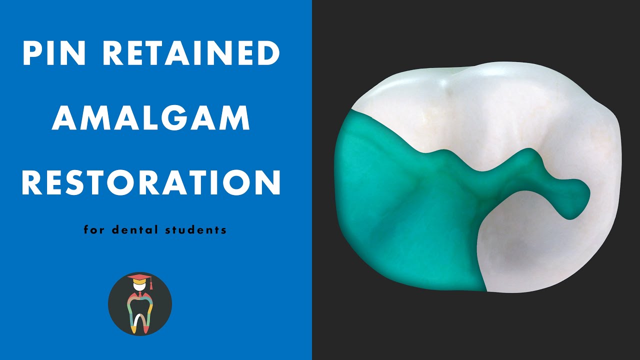 Pin Retained Amalgam Restoration