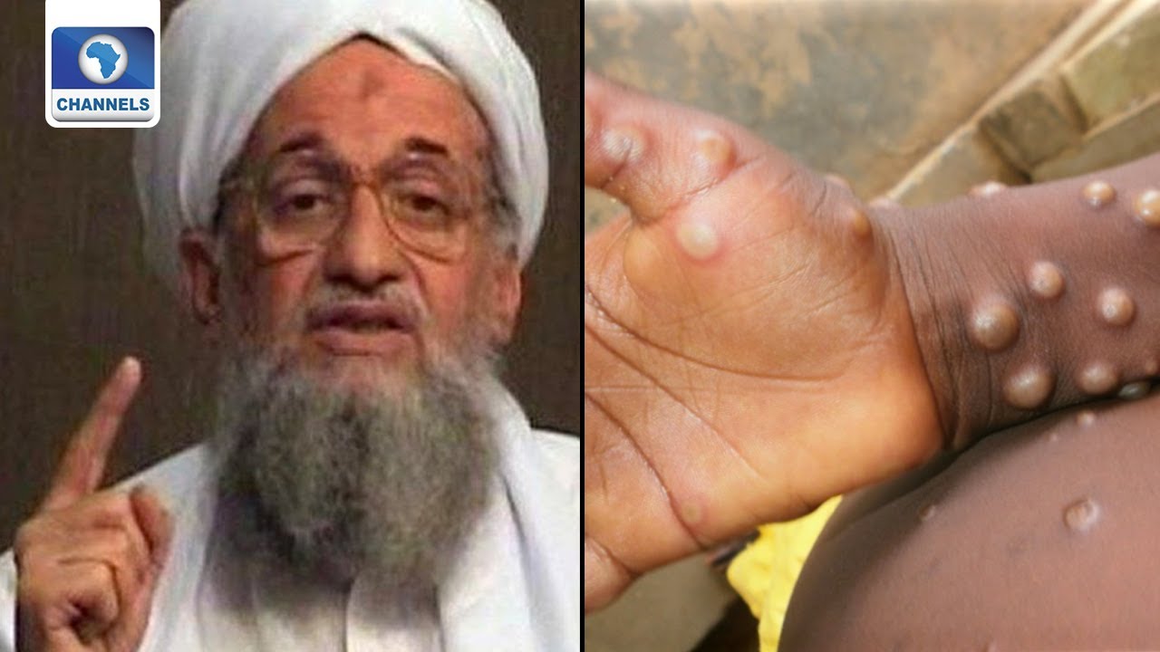 Killing Of Al-Zawahiri, Monkey Pox In India + More | The World Today