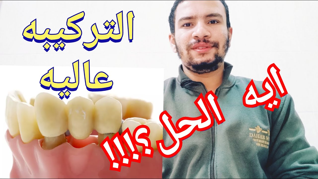 مشاكل التركيبات الثابته للاسنان التركيبه مرتفعه و مش قادر استخدمها