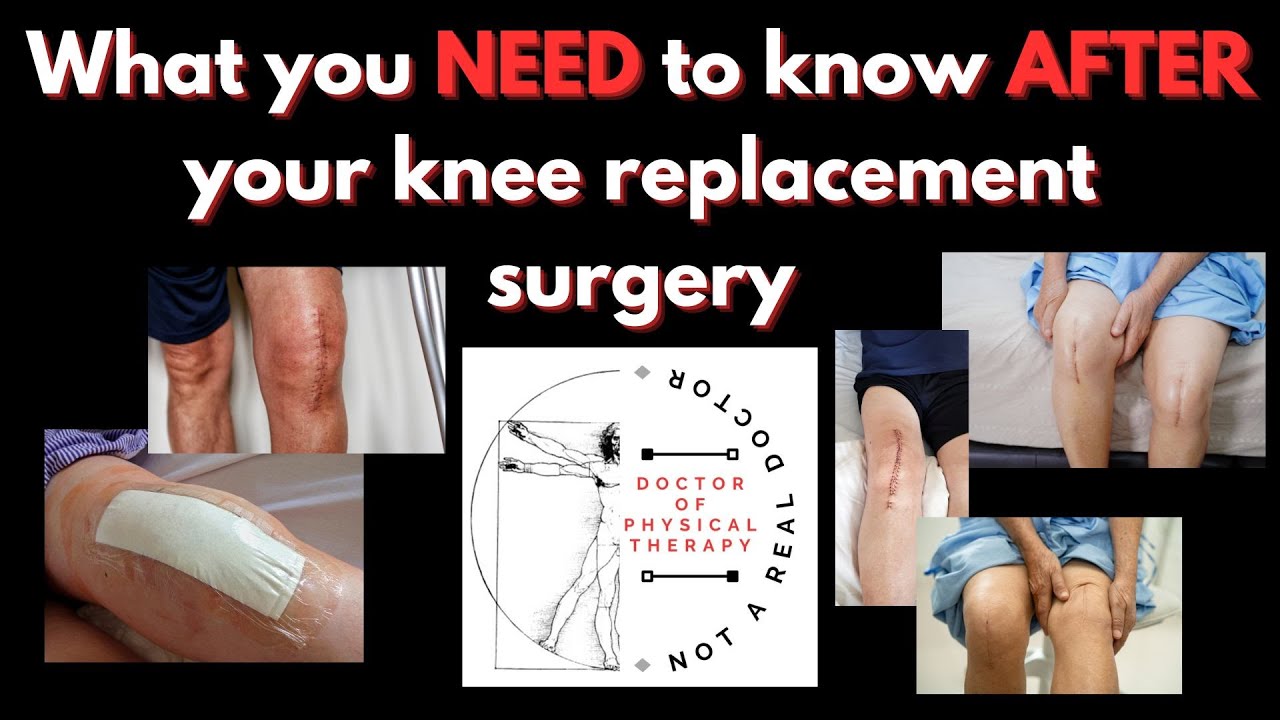 ВАЖНО: СМОТРИТЕ ЭТО ПОСЛЕ ТКА!