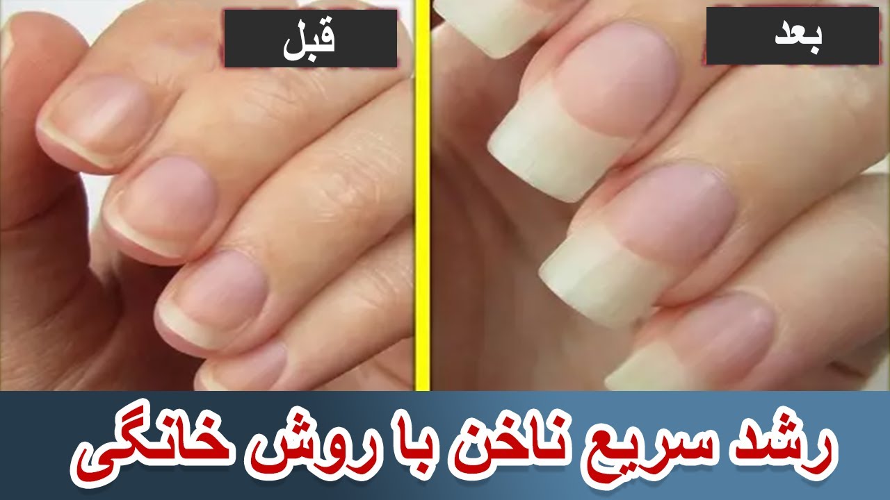 ماسک خانگی بسیار موثر برای رشد و تقویت ناخن ها