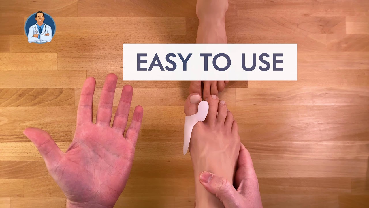 How Bunions form? | Dr. Frederick's Original