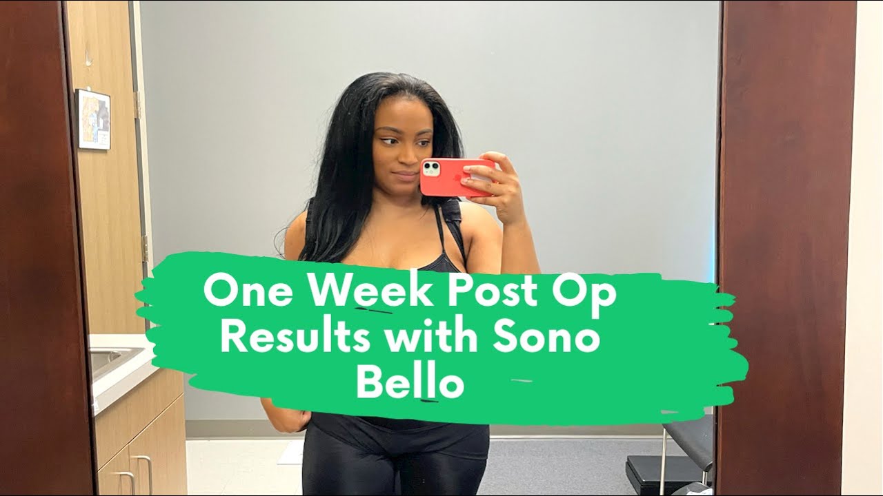 One Week Post Op appointment with Sono Bello! Side by side Results