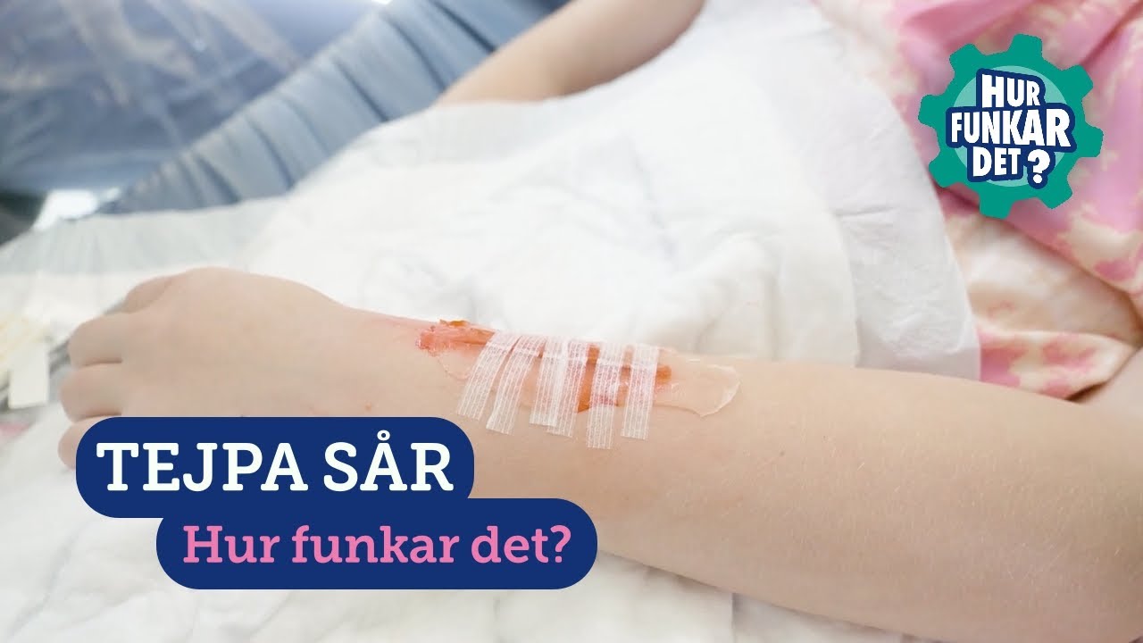 Tejpa ett sår