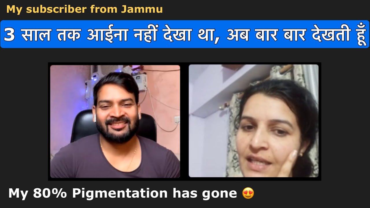 3 साल तक आईना नहीं देखा था, अब बार बार देखती हूँ I My 80% Pigmentation has gone & I look good too