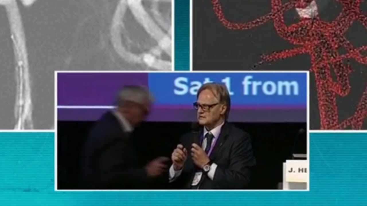 Linnc (Paris 2012) - Hybrid Neurosurgery