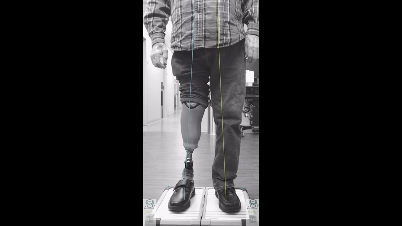 3D L.A.S.A.R. Posture device from Ottobock | JP&O