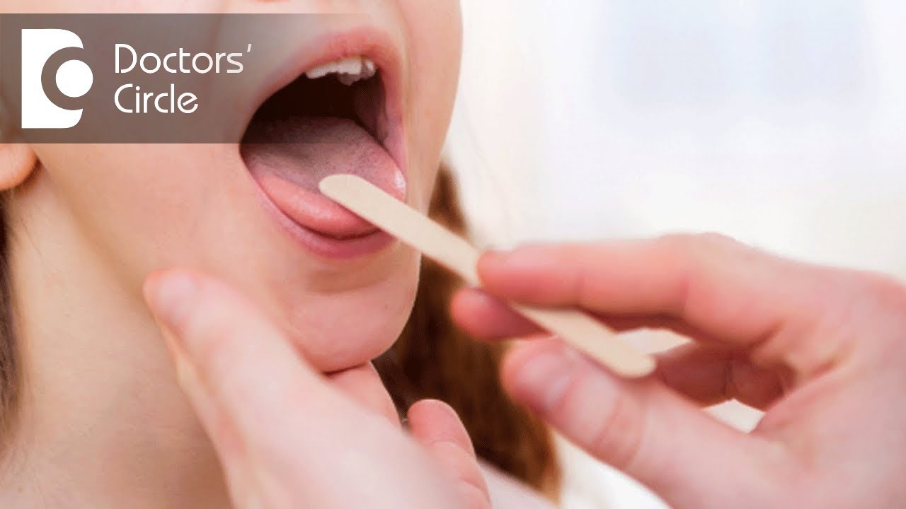 What is Oral placement therapy? - Namrata Pai