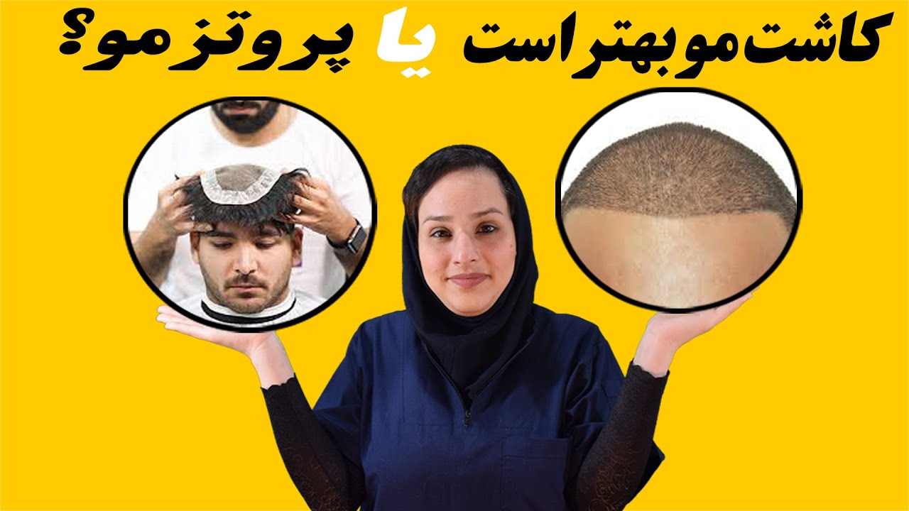 پروتز مو بهتر است یا کاشت مو؟ 7 تفاوت مهم کاشت مو با پروتز مو