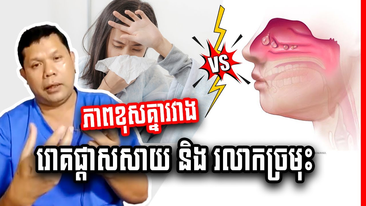 រោគផ្តាសសាយ និង រលាកឆ្អឹងប្រអប់ច្រមុះ ខុសគ្នាដូចម្តេចខ្លះ? វេជ្ជ. ហែន ភារៈ