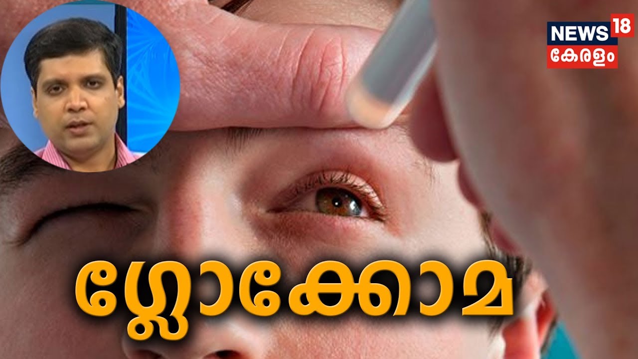 Dr Q : ഗ്ലോക്കോമ; രോഗനിര്‍ണയവും ചികിത്സാ രീതികളും | Glaucoma | 2nd May 2019