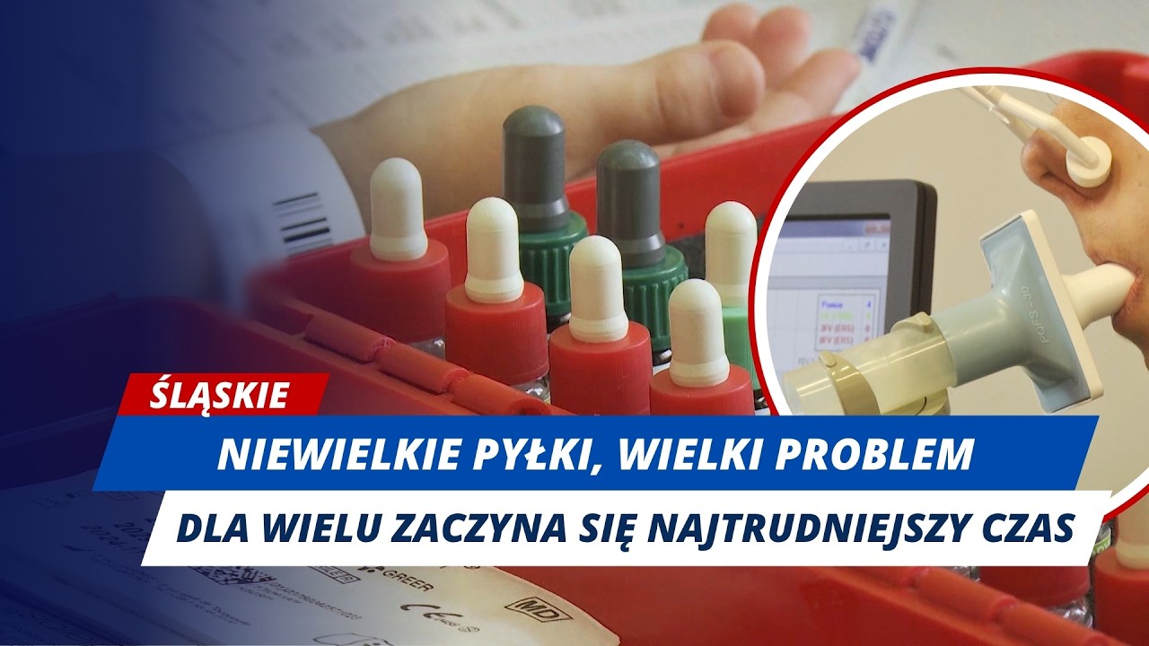 EPIDEMIA XXI WIEKU?