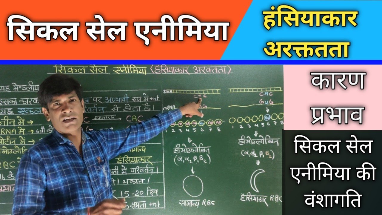 सिकल सेल एनीमिया। हंसियाकार अरक्ततता।। दात्र कोशिका अरक्ततता। Sickle cell anaemia.