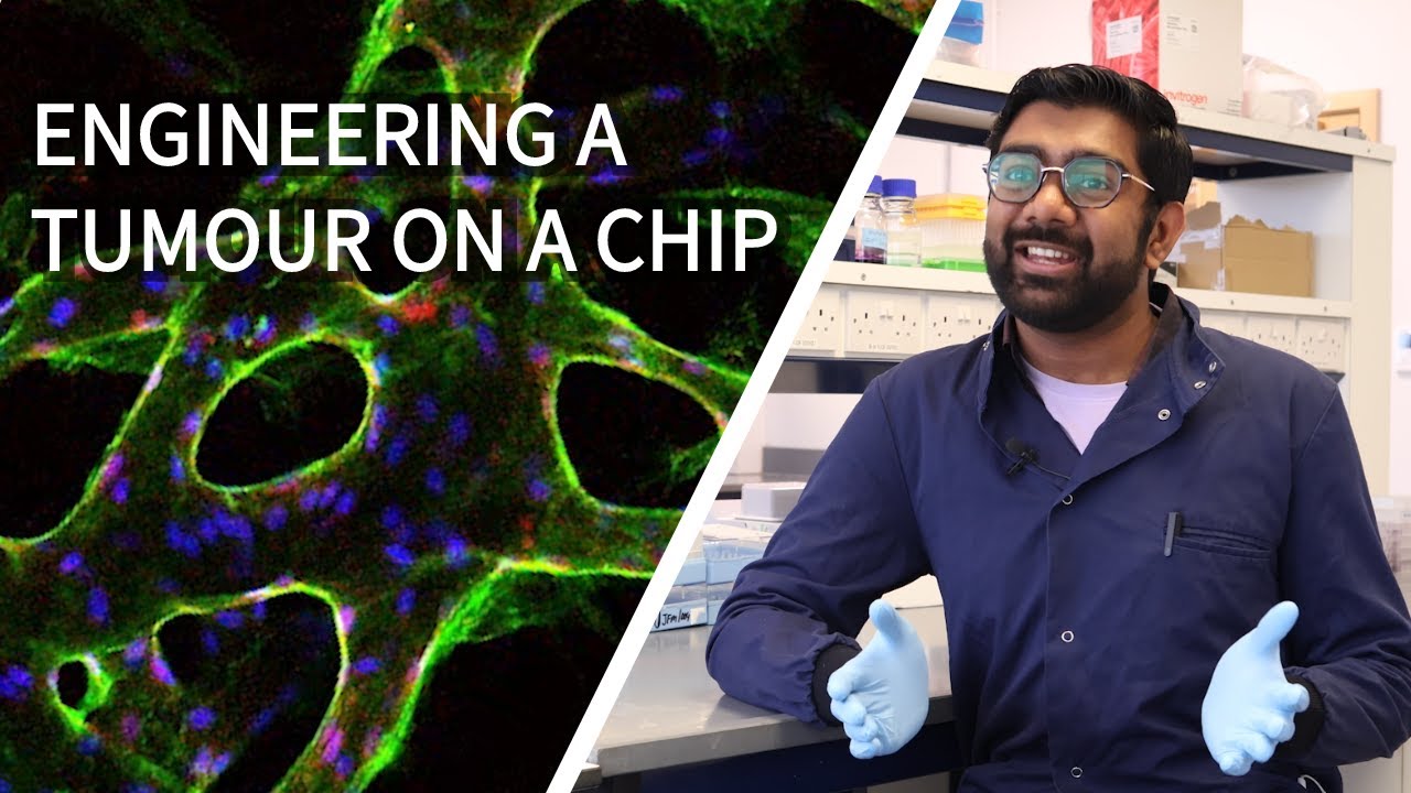 Engineering a Tumour on a Chip - How Cutting-Edge Cancer Research is Helping to Improve Treatments