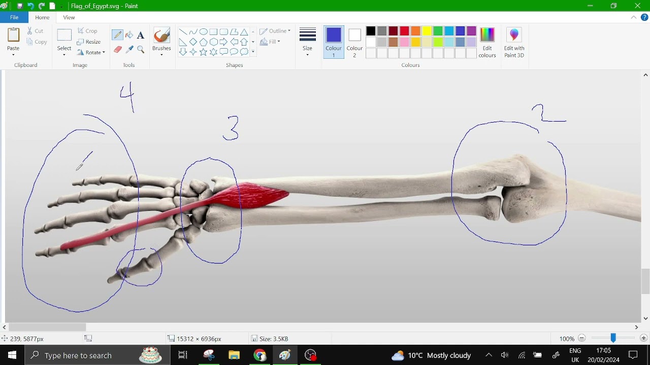2. Muscles innervated by RADIAL nerve