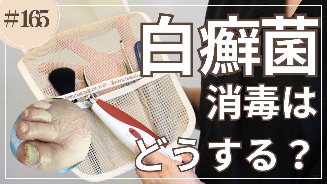 #165   白癬菌と消毒はどうする？