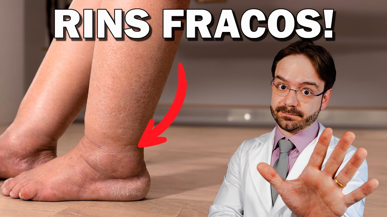 7 Sinais Que Seu Rim Não Vai Bem!