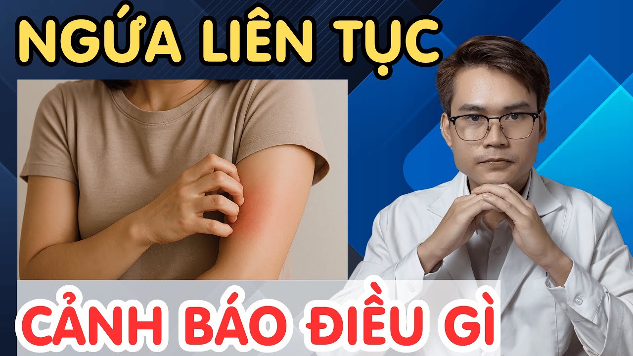 Ngứa M&atilde;i Kh&ocirc;ng Hết &ndash; B&iacute; Mật C&aacute;c Bệnh L&yacute; Tiềm Ẩn | B&aacute;c sĩ Phạm Tuấn